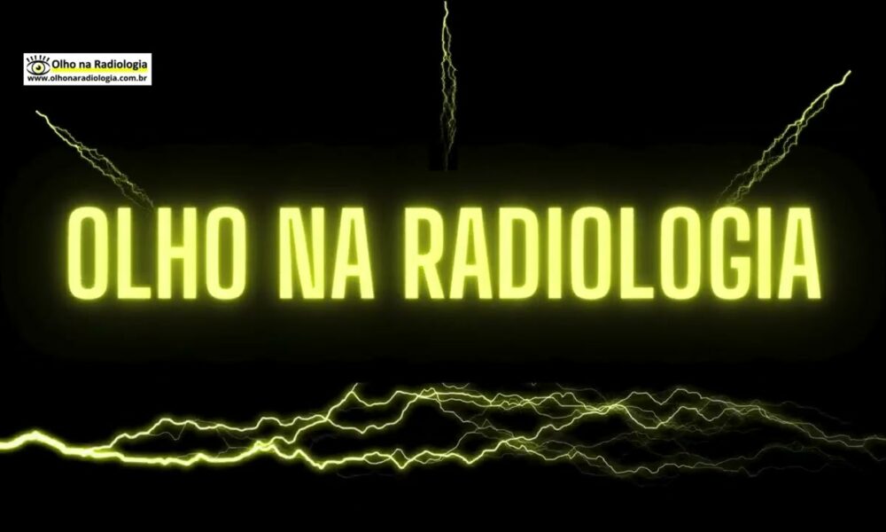 Site e Canal do YouTube - Site:   www.olhonaradiologia.com.br