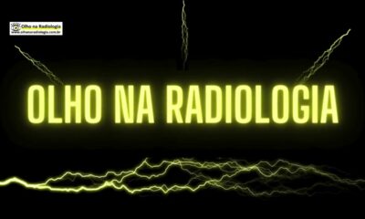 Site e Canal do YouTube - Site:   www.olhonaradiologia.com.br